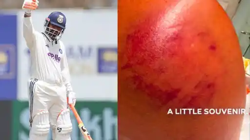 Rishabh Pant shows the visible bruising on his shoulder in a picture shared after India's series-winning Test against Sri Lanka in Colombo